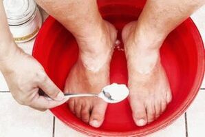 Bathing with soda soap and tar will get rid of foot fungus